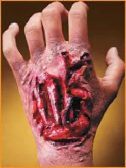 Reel F/X Torn Up Hand Prosthetic